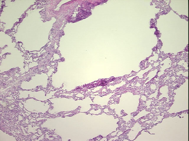 4x Image