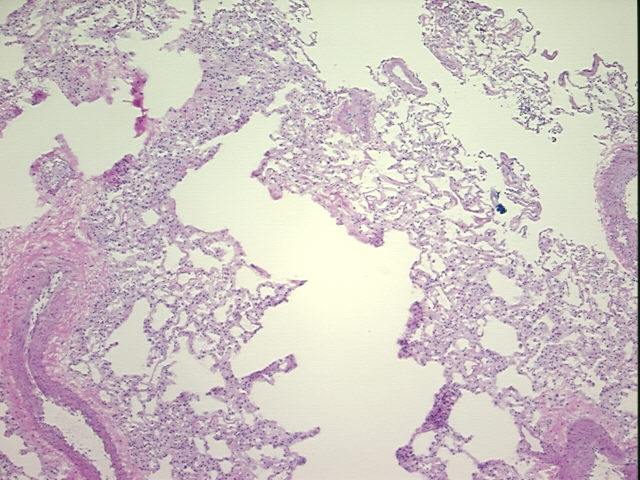 4x Image
