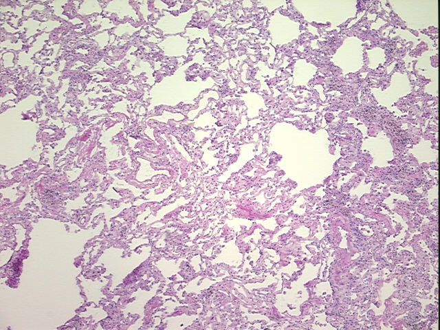 4x Image