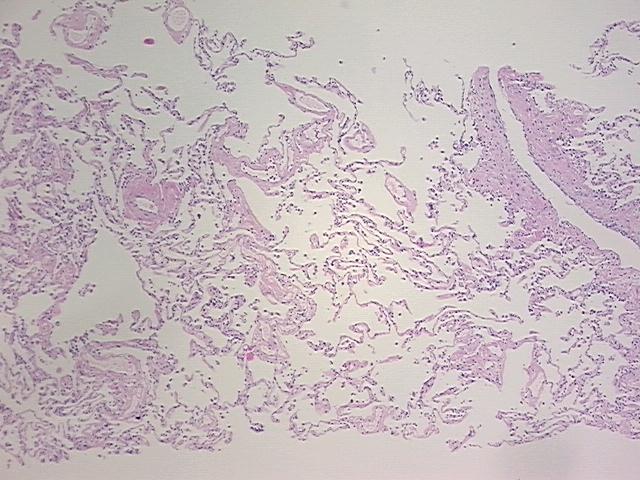 4x Image