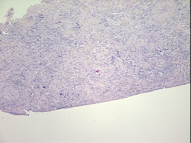 4x Image