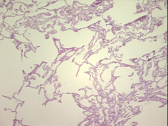 4x Image