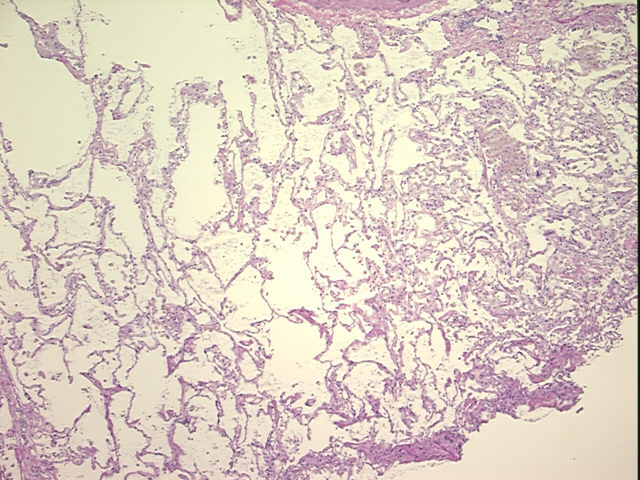 4x Image