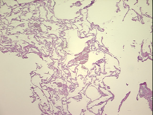 4x Image