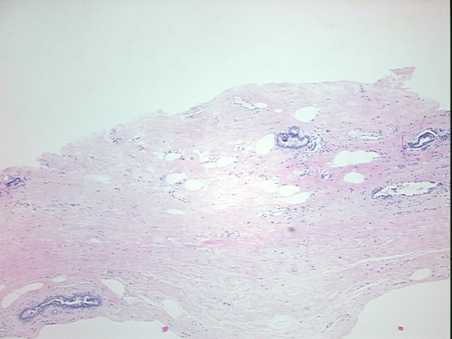 4x Image