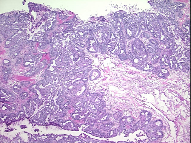 4x Image