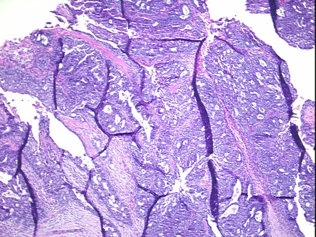 4x Image