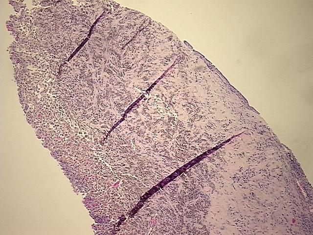 4x Image
