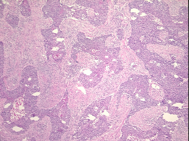 4x Image