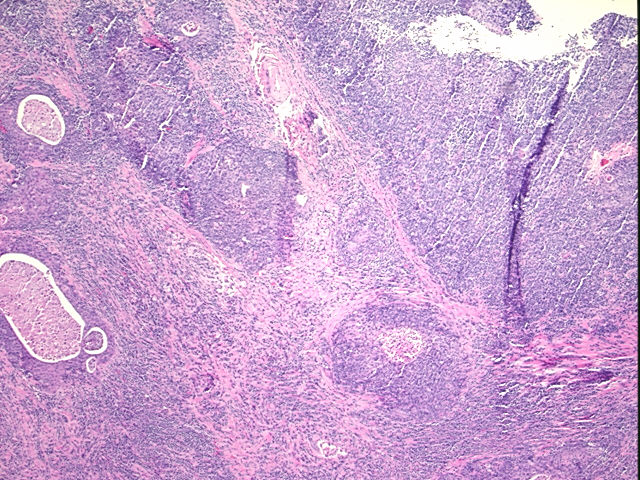 4x Image