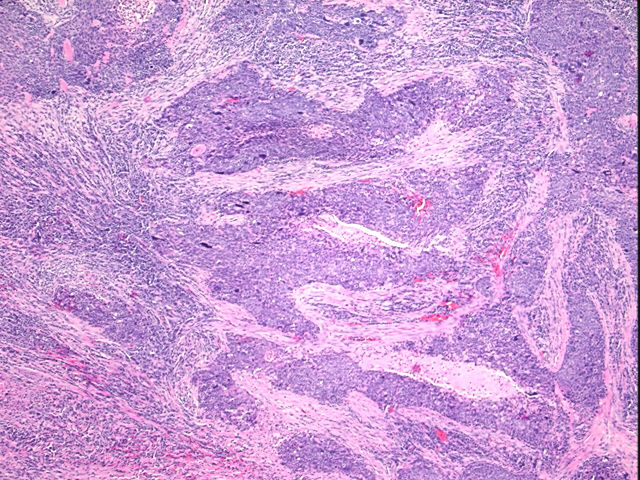 4x Image
