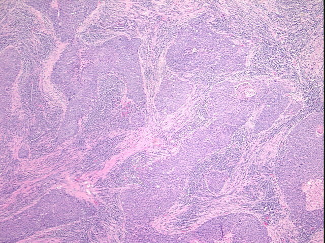 4x Image
