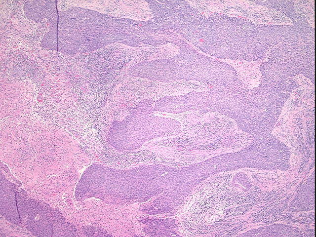 4x Image