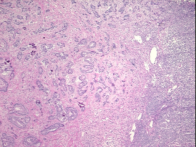 4x Image