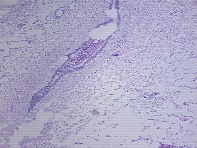 4x Image