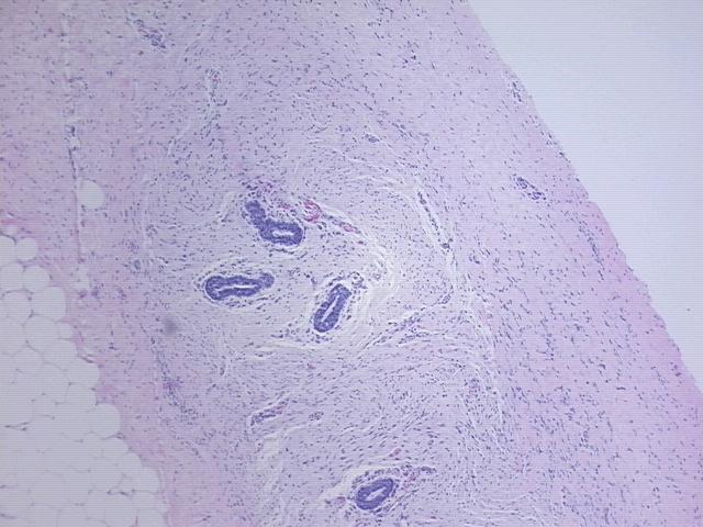 4x Image