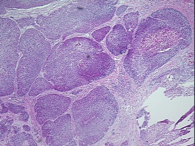 4x Image