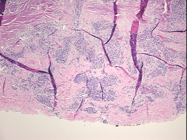 4x Image