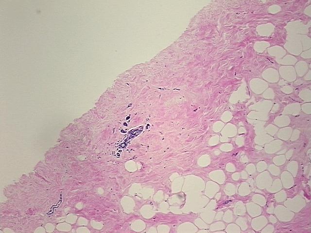 4x Image