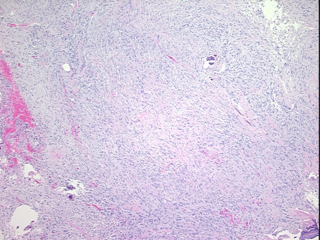 4x Image