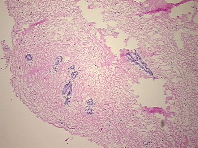 4x Image