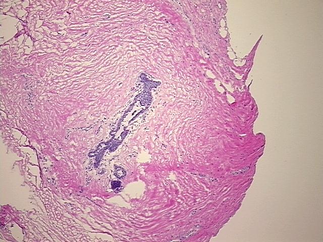 4x Image