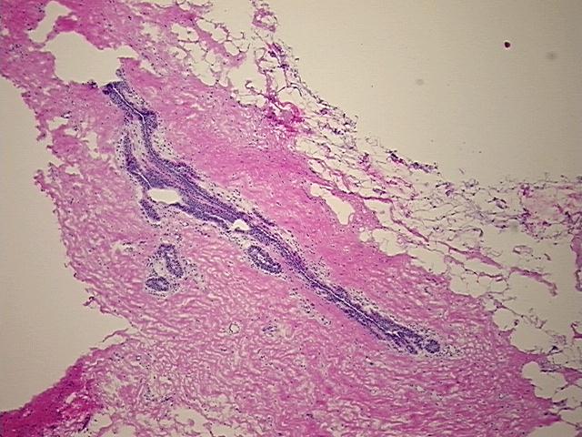 4x Image