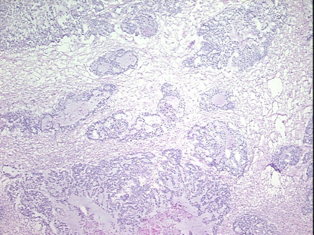 4x Image