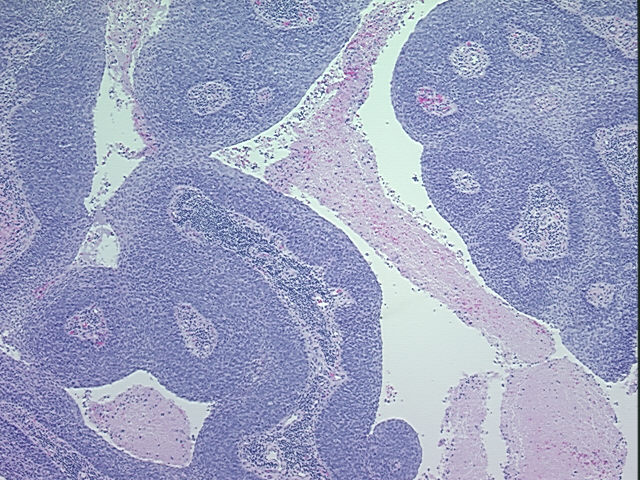 4x Image