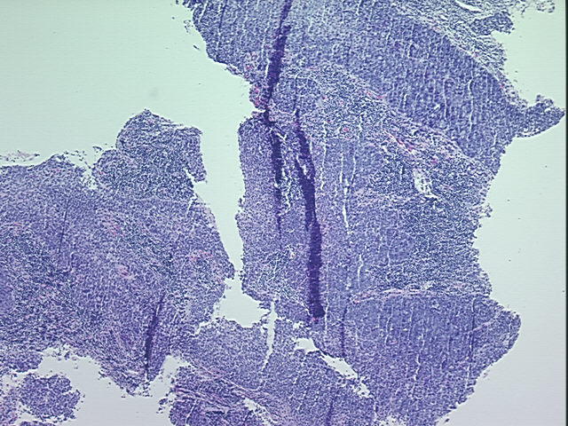 4x Image