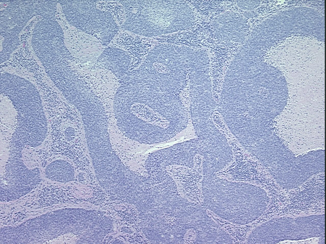 4x Image
