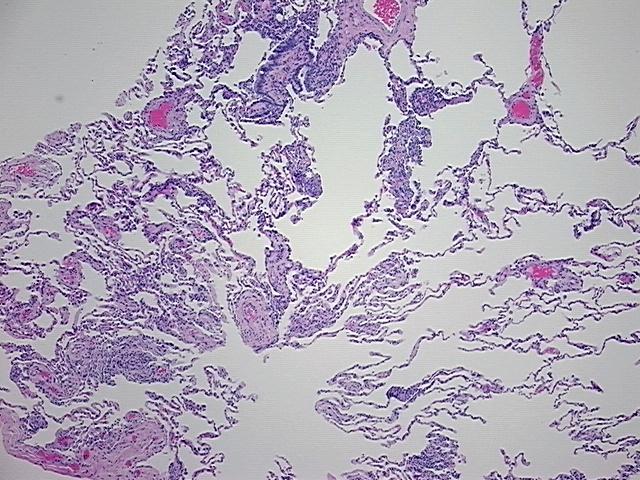 4x Image