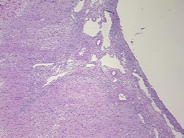 4x Image