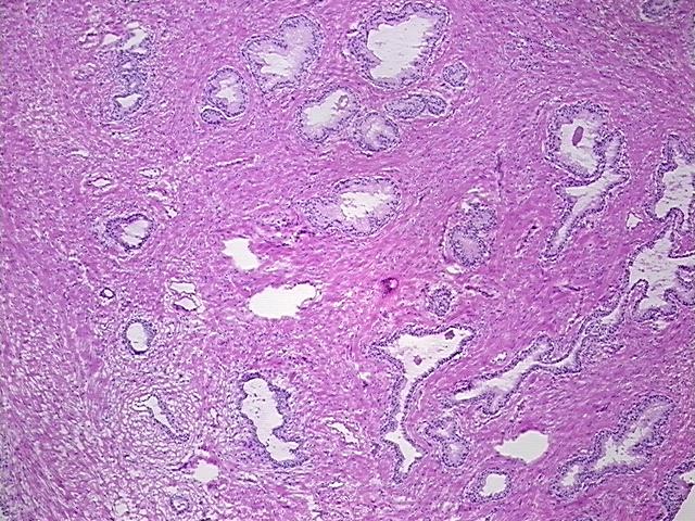 4x Image