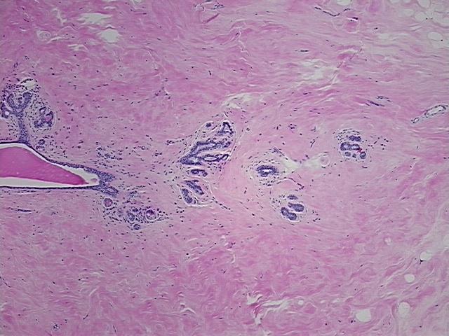 4x Image