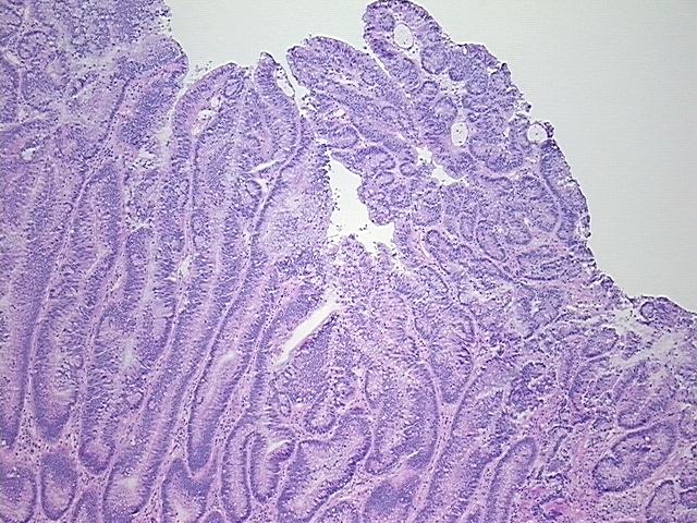 4x Image