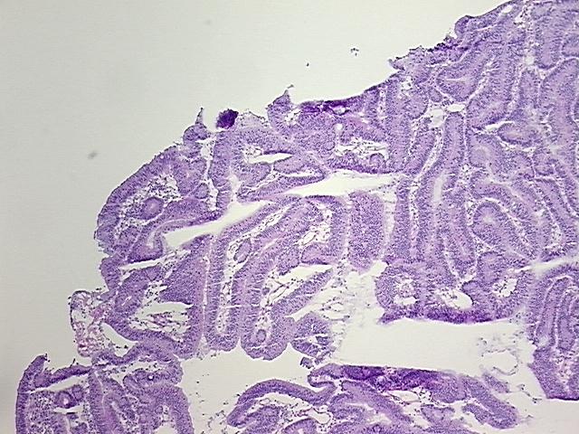 4x Image
