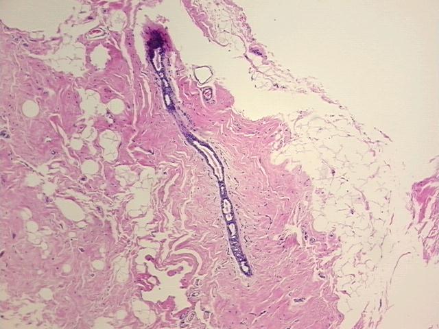 4x Image