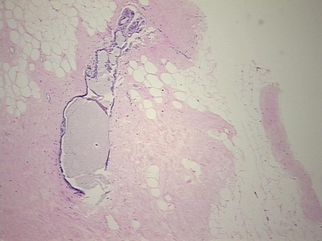 4x Image