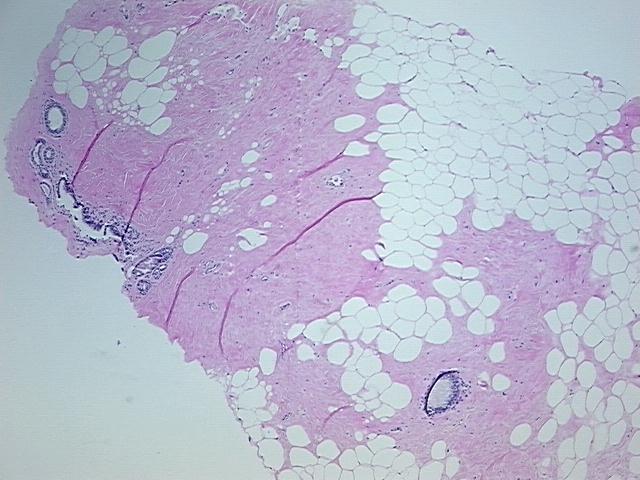 4x Image