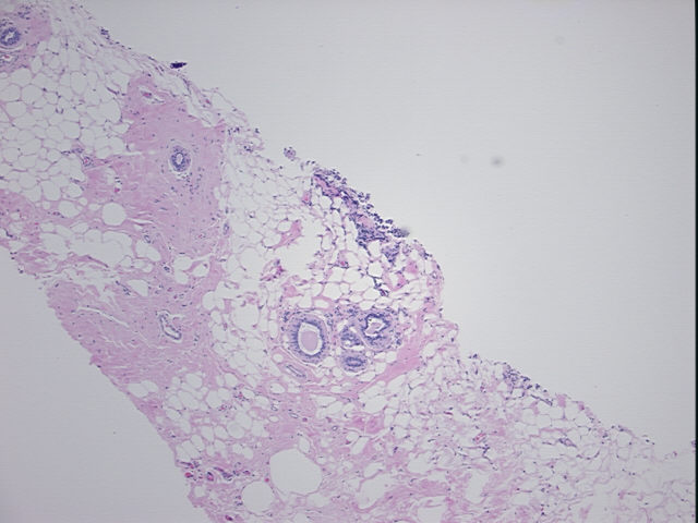 4x Image