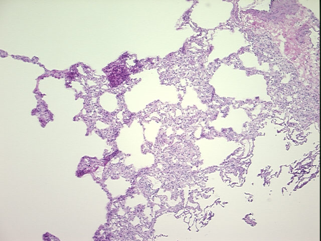 4x Image