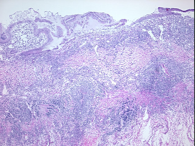 4x Image