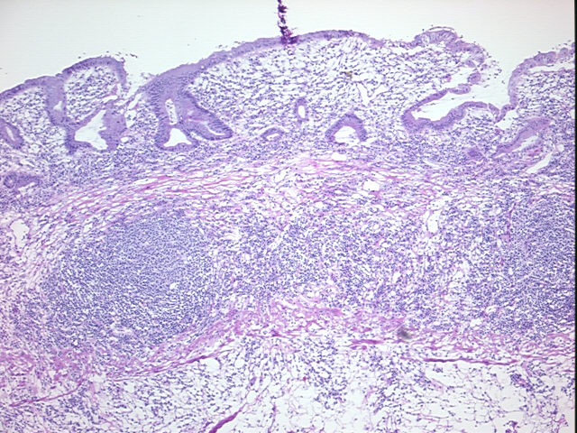4x Image