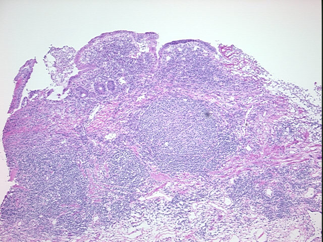 4x Image