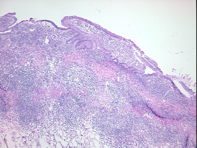 4x Image
