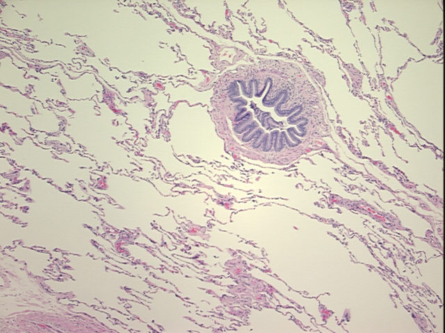 4x Image