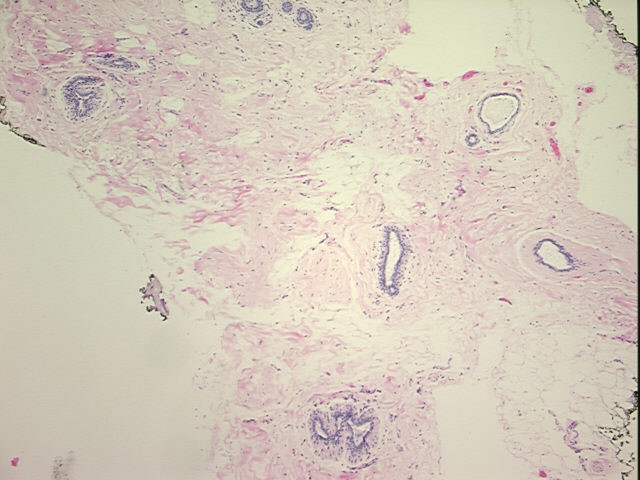 4x Image