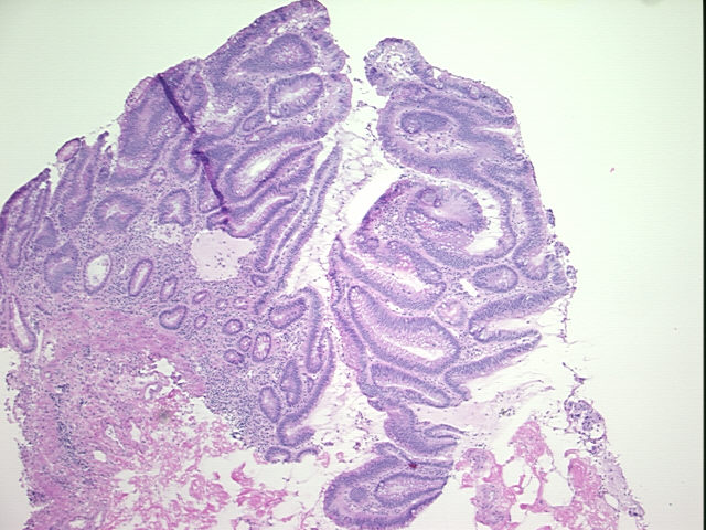 4x Image