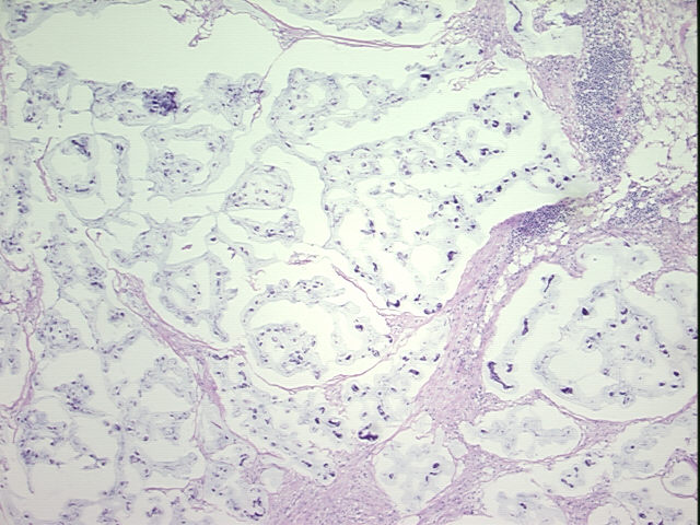 4x Image